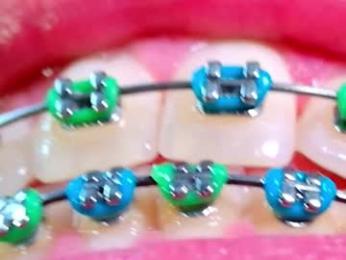 los_juanes webcam chaturbate model stream image